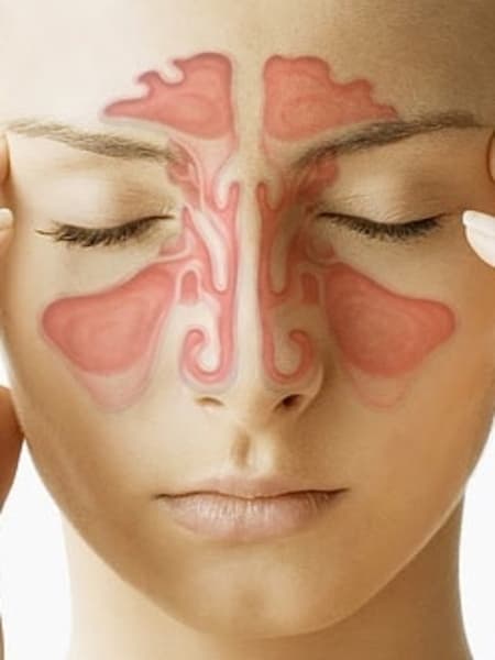 Sinus Essential Oil Blend